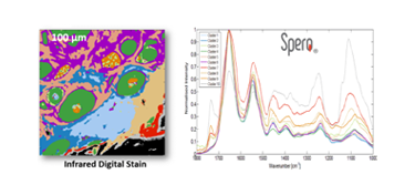 Laser 2000 Photonics – Fighting Cancer